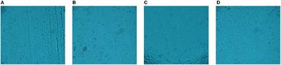 Propidium Monoazide Combined With RT-qPCR Detects Infectivity of Porcine Epidemic Diarrhea Virus